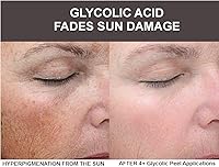 Planet Eden 80% GlyLactic Skin Chemical Peel — image 2