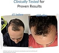 REKZE 24 Serum for Hair Regrowth – 2.12oz — image 6