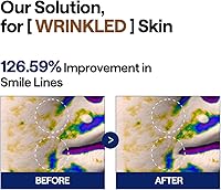 Mediheal Retinol Collagen Lifting Pad 100 Pads — image 4