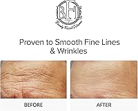 Beauty Facial Extreme Glycolic Acid 15% Anti-Aging Cream — image 3