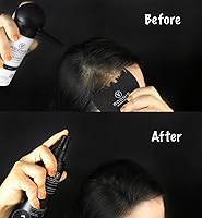 Adonis 5-in-1 Hair Fiber Kit (Black) — image 4