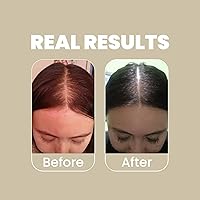 Anyeluz Rosemary Shampoo and Conditioner Set — image 5