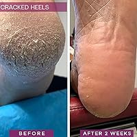 SkinIntegra Rapid Crack Repair Cream 25% Urea, 3oz — image 3