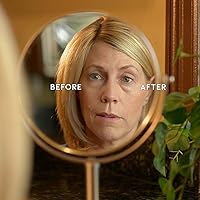 Eye Magic Premium Eye Lift (S/M Kit + Gel) — image 7