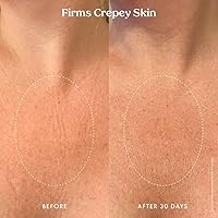 Kopari Ultra Renewal Retinol Body Cream 4.7oz — image 5