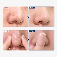 TOSOWOONG AHA Blackhead Out Cleansing Oil, 150mL — image 3