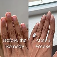 Botanist Nail Rescue Kit | Nail Strengthening Polish + Growth Serum (Nude) — image 5