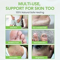 Thena Athlete’s Foot Cream 2oz — image 5