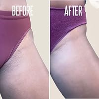 Divine Derriere Intimate Skin Lightening Gel for Body and Bikini Area — image 8