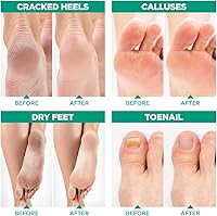 LV LAVINSO Tea Tree Oil Foot Soak with Epsom Salt - 2 LB — image 5