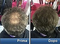 Pantogar Hair and Nails Treatment 90 Caps — image 3