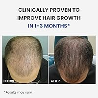 ForHair Men Hair Growth Spray — image 2