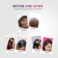 Maka Capillary Hair Growth Drops 4 Oz with 1.5% Minoxidil — image 7