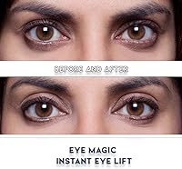 Eye Magic Premium Eye Lift (S/M Kit + Gel) — image 2