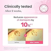 CNP PDRN + Tranexamic Acid Serum 15% — image 4