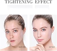 Instalift Protein Thread Lifting Set — image 2