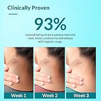 Fixderma Nigrifix Cream 3.52oz — image 6