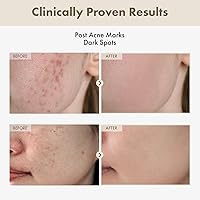 TOSOWOONG Alpha Arbutin 2% Rice Serum 33ml — image 2