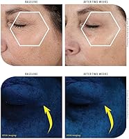 MICHAEL TODD Beauty KNU Cream – Face Lifting & Brightening 50mL — image 6