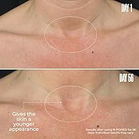 MAËLYS Cosmetics B-POISED Neck & Décolleté Firming Cream 1.7oz — image 4