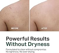 Y'OUR Acne Clearing Body Wash 10.1oz — image 3