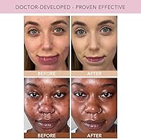 Doll 10 TCE Liquid Filter CC Cream - Tan/Deep - 30 Day Supply — image 3