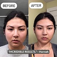 Mount Lai Jade Gua Sha Facial Tools Set — image 4