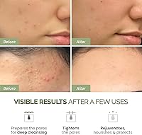 PLANTIFIQUE Korean Skincare Clay Mask – 3.4oz — image 2