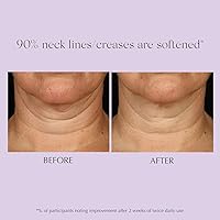 Exuviance Age Reverse+ Toning and Firming Neck Cream 4.4oz — image 7