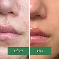 LAPALETTE Calming Green Turnover Toner 6.75oz — image 5