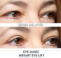Eye Magic Premium Eye Lift (S/M Kit + Gel) — image 3