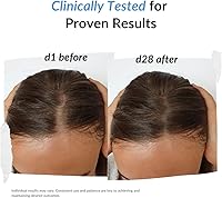 REKZE 24 Serum for Hair Regrowth – 2.12oz — image 5