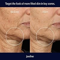 Estée Lauder Perfectionist Pro Rapid Firm + Lift Face Serum 1.7oz — image 3