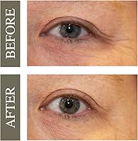 Hey Honey Open Your Eyes Lifting Eye Serum 0.5 oz — image 3