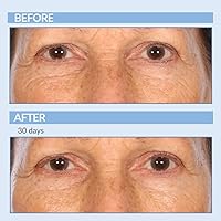 Serious Skincare Retinol Anti-Aging Skin Care Set — image 3