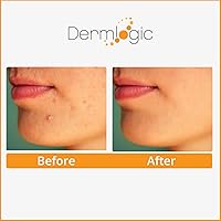 Dermlogic Acne Treatment Pads - 2% Salicylic Acid, Exfoliating, Unscented — image 6