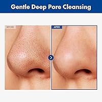 TOSOWOONG AHA Blackhead Out Cleansing Oil, 150mL — image 2