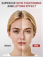 Rantxiny Face Massager with Red Light Therapy — image 2