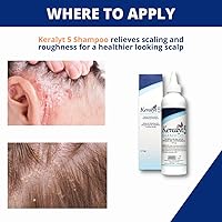 Keralyt 5 Anti-Dandruff Shampoo 177mL — image 4