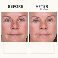 Serious Skincare Reverse Lift Firming Facial Serum, 1 oz — image 6