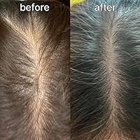 Vivelab Scalp&Hair Serum for Thinning Hair 15mL — image 7