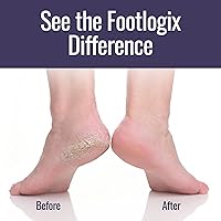Footlogix Foot Care Callus Softener Combo — image 4