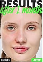 Fation NOSCA9 Soothing Cream S 1.52 Fl Oz — image 5