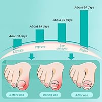 Twoant Titanium Alloy Ingrown Toenail Treatment Kit (9PCS) — image 2