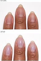 Dermelect Instant Nail Makeover Trio - 3 pc Set — image 4