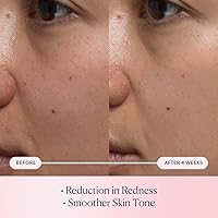 ELEMIS Pro-Collagen Rose Micro Serum 4.48oz — image 3