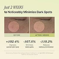 OOZNARY Vita 3 Serum with Vitamin C & Niacinamide, 50mL — image 4