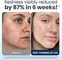 Clean Skin Club Clean Towels XL, 100% Biobased Face Towels, 100 Count — image 3