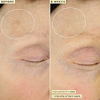 Farmacy 10% Vitamin C Serum for Face 30mL — image 7