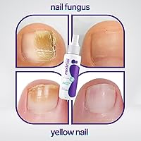 Bubbly Cosmetics Medinail Advanced Foot and Nail Spray 3.38oz — image 6